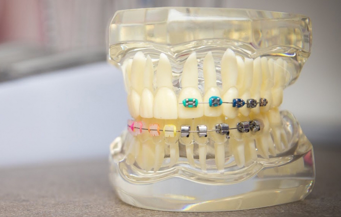 Duo Dental fogászati ajándékkártya